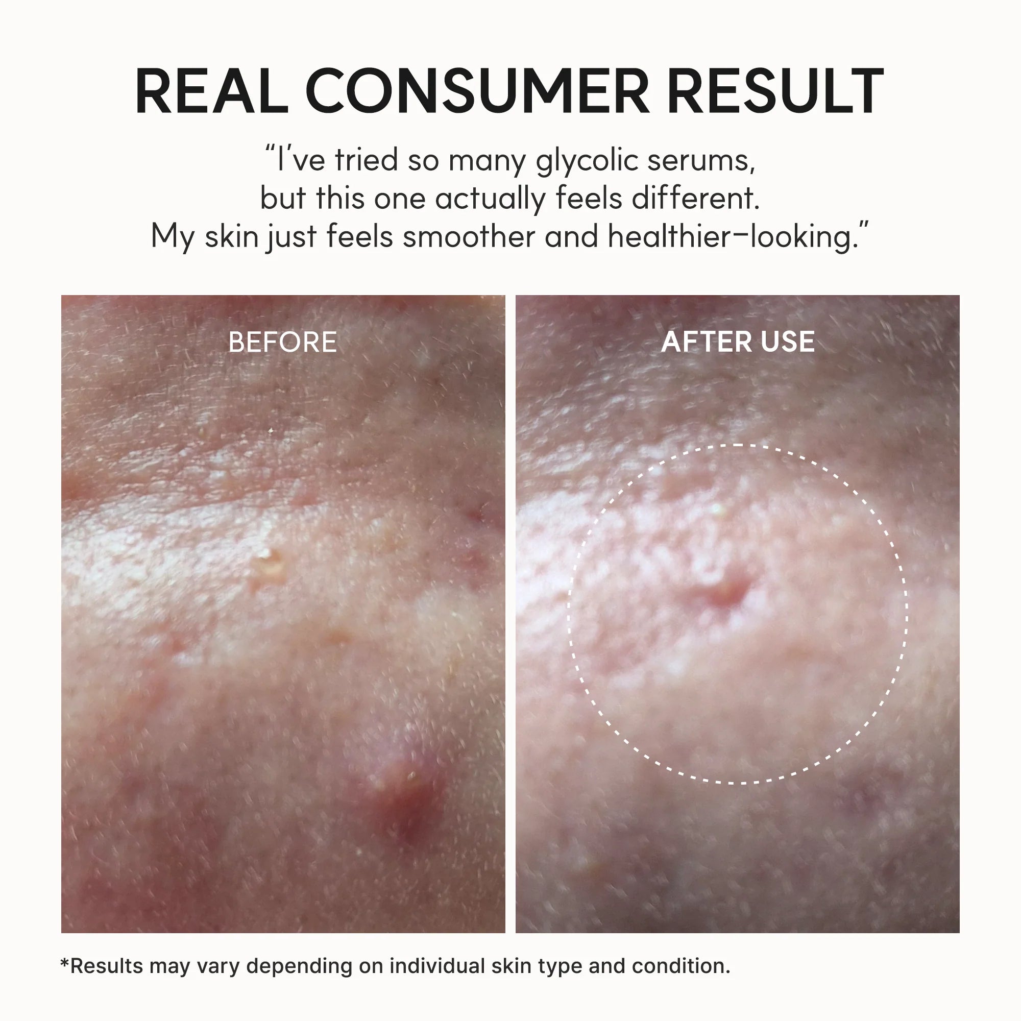 Arencia Eraser Shot Glycolic Acid Booster
