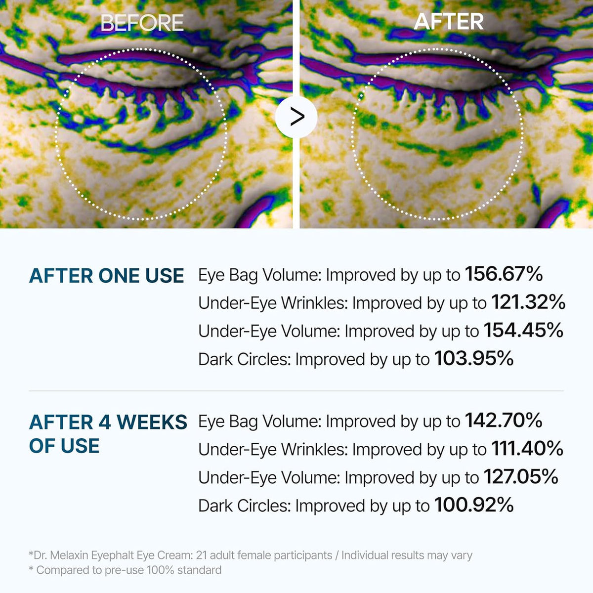 Dr.Melaxin Eyephalt Eyebag Cream — 10 ml