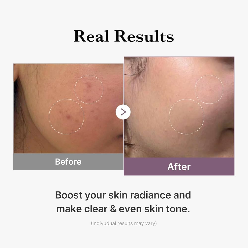 Medicube AGE-R Glutathione Glow Toner – 140ml