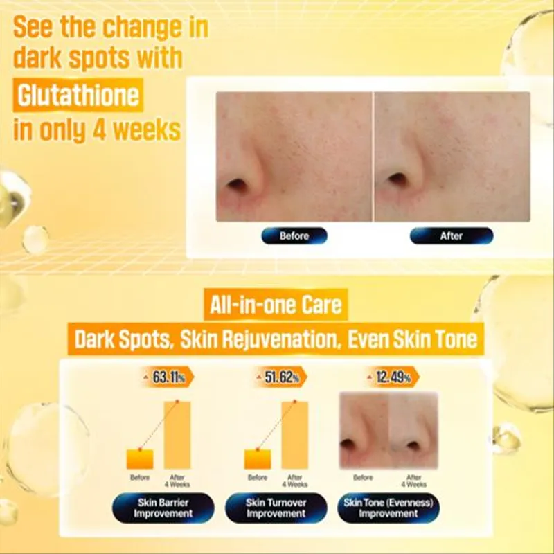 Numbuzin – No.5+ Vitamin Glutathione Dark Spot Laser Cream