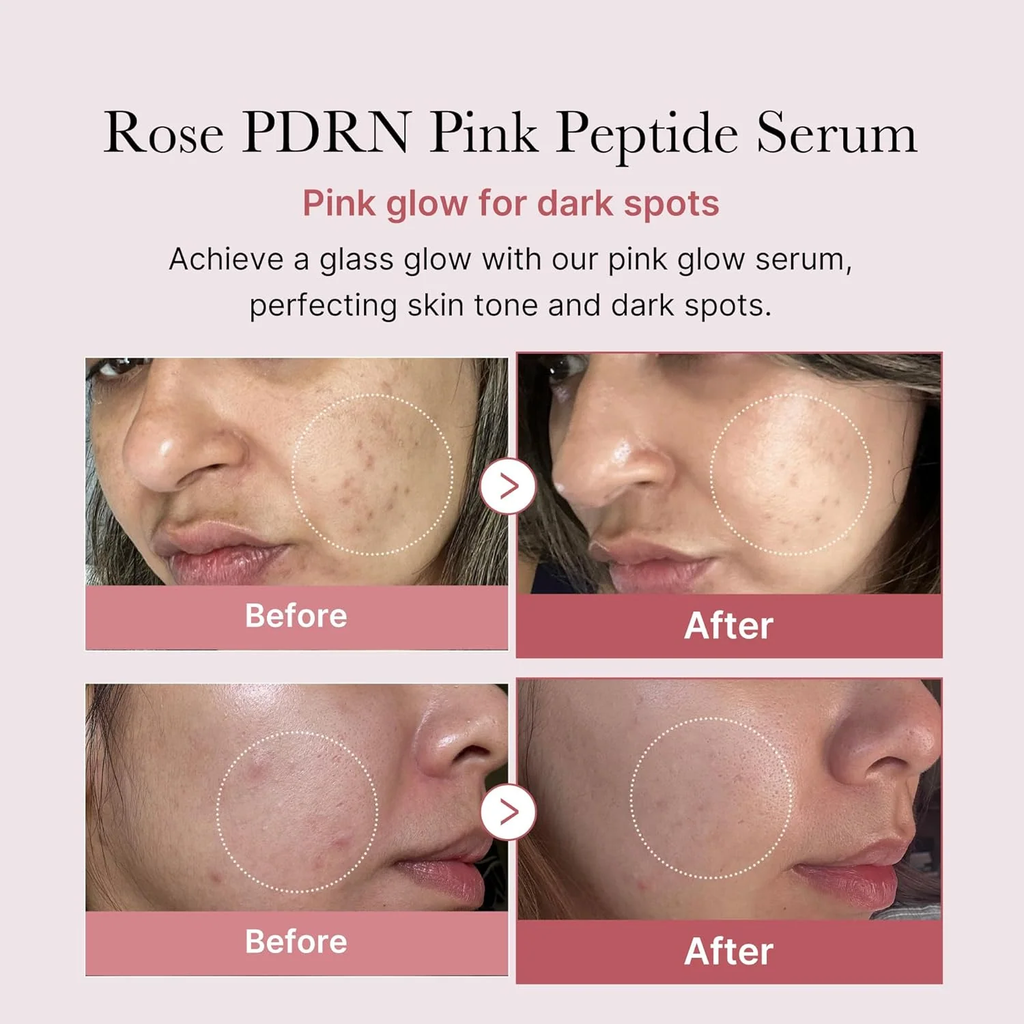 MEDICUBE COLLAGEN PDRN PINK PEPTIDE SERUM 30ML.